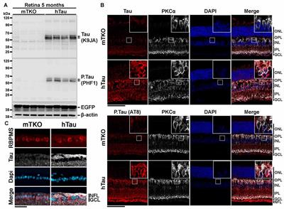 Human Tau Expression Does Not Induce Mouse Retina Neurodegeneration, Suggesting Differential Toxicity of Tau in Brain vs. Retinal Neurons
